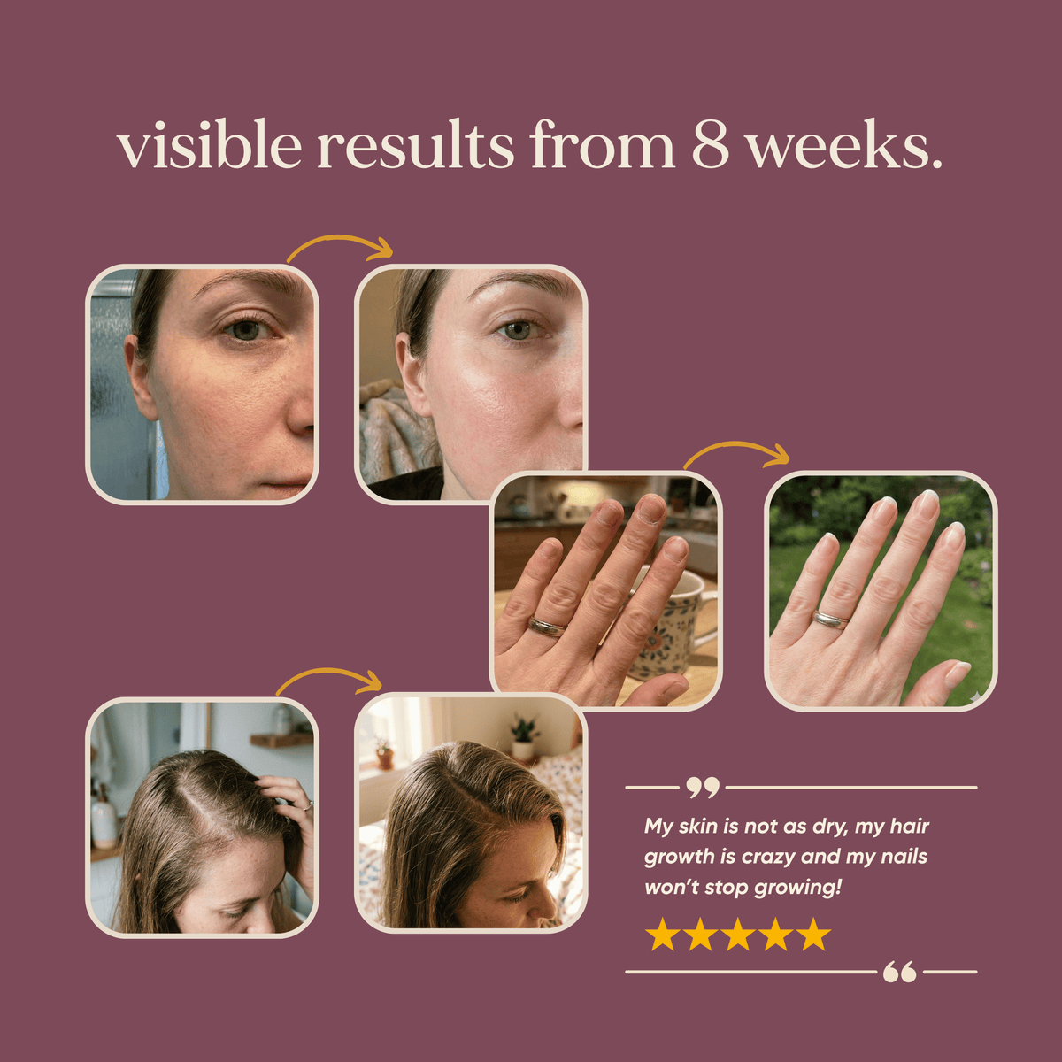 Kind Collagen with Hyaluronic Acid & Vitamin C (Vegan)  -  Omvits